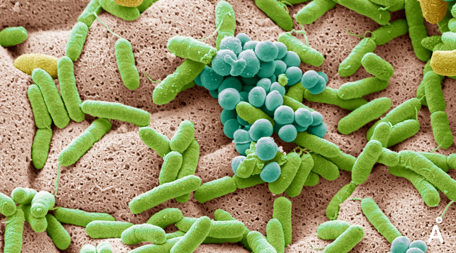 Darm & Immunsystem – Die Schlüsselrolle des Mikrobioms